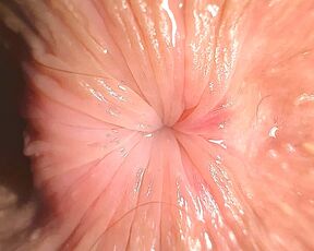 EXTREME CLOSE UP: Teenage butthole is trying to kiss you trough the screen of your IPhone